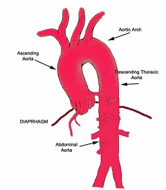 Схема дуги аорты