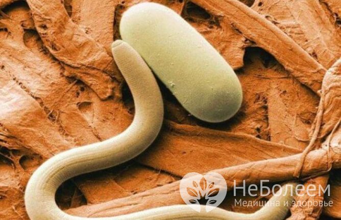 Анизакидов – паразитарное заболевание, возбудителем которого является личинка нематод семейства Anisakidae