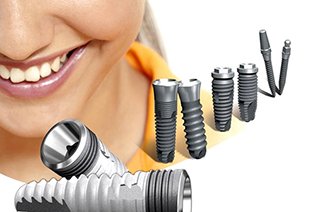 Современные дентальные импланты: Osstem, Nobel, Astra