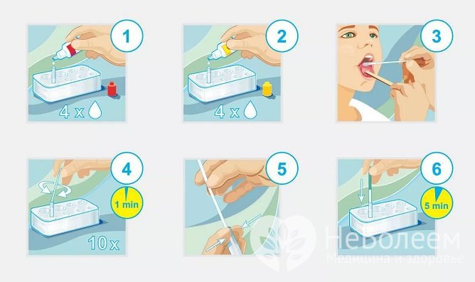 Для быстрого выявления бета-гемолитического стрептококка группы А проводится экспресс-тест