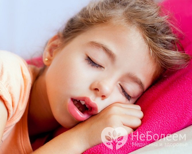 У детей с назофарингитом постоянно открыт рот из-за нарушенного носового дыхания