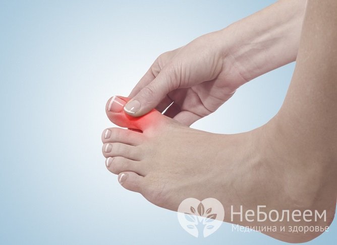 Ушиб пальца на ноге обычно возникает из-за бытовой или спортивной травмы